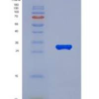 人整合素α1(ITGa1)重组蛋白