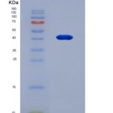 人核因子κB受体激活因子(RANk)重组蛋白