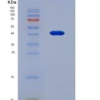 人核因子κB受体激活因子(RANk)重组蛋白