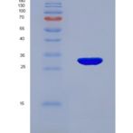 小鼠丝氨酸蛋白酶1(PRSS1)重组蛋白