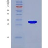 小鼠丝氨酸蛋白酶1(PRSS1)重组蛋白