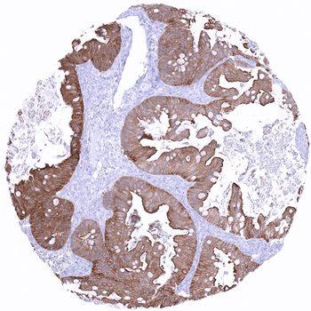 Villin antibody 抗体，orb2276491，