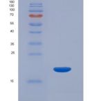 人血红蛋白α1(HBa1)重组蛋白