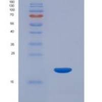 人血红蛋白α1(HBa1)重组蛋白