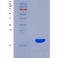 人膜糖蛋白Ⅵ(GP6)重组蛋白