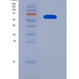 人异亮氨酰tRNA合成酶(IARS)重组蛋白