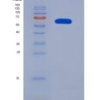 人异亮氨酰tRNA合成酶(IARS)重组蛋白
