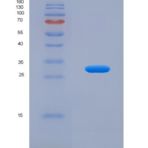 人孕酮免疫调节结合因子1(PIBF1)重组蛋白