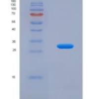 人孕酮免疫调节结合因子1(PIBF1)重组蛋白