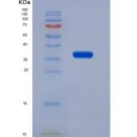 人多功能蛋白聚糖(VCAN)重组蛋白