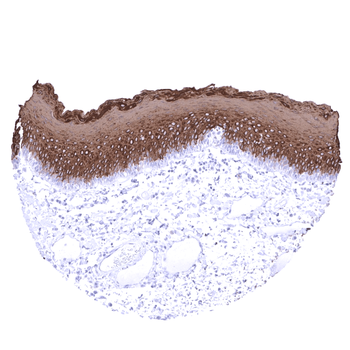 Cytokeratin 13 antibody 抗体，orb