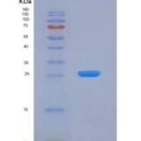 人多巴胺受体D2(DRD2)重组蛋白