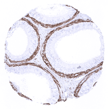 Calponin 1 antibody 抗体，orb2276