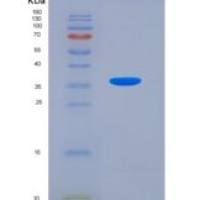 人钙敏感受体(CASR)重组蛋白