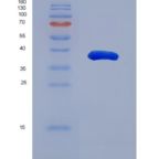 小鼠醛脱氢酶1家族成员A1(ALDH1A1)重组蛋白