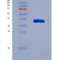 小鼠醛脱氢酶1家族成员A1(ALDH1A1)重组蛋白
