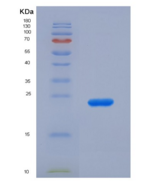人唾液酸结合Ig样凝集素12(SIGLEC12)重组蛋白