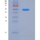 人雌激素受体β(ERb)重组蛋白