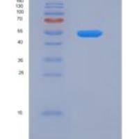 人雌激素受体β(ERb)重组蛋白