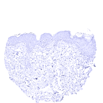 Cytokeratin 13 antibody 抗体，orb