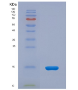小鼠结缔组织生长因子(CTGF)重组蛋白