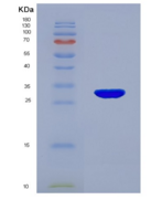 小鼠丝氨酸蛋白酶1(PRSS1)重组蛋白