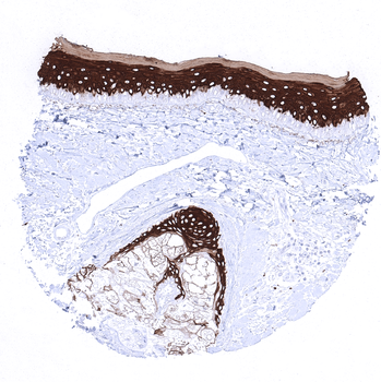 Cytokeratin 10 antibody 抗体，orb