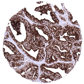 PSAP antibody 抗体，orb2276502，Bi