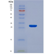 人解整合素金属蛋白酶17(ADAM17)重组蛋白