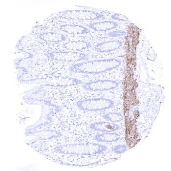 Calponin 1 antibody 抗体，orb2276