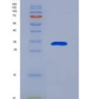 人促性腺激素释放激素受体(GnRHR)重组蛋白