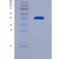 小鼠G蛋白偶联雌激素受体1(GPER)重组蛋白