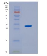 人磷酸肌醇依赖性蛋白激酶1(PDPK1)重组蛋白