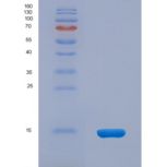 小鼠结缔组织生长因子(CTGF)重组蛋白