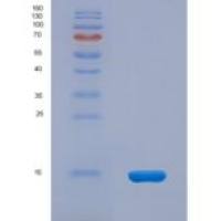 小鼠结缔组织生长因子(CTGF)重组蛋白