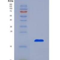 小鼠Cereblon蛋白(CRBN)重组蛋白