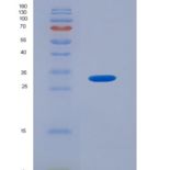 人磷酸肌醇依赖性蛋白激酶1(PDPK1)重组蛋白