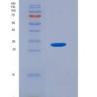 人磷酸肌醇依赖性蛋白激酶1(PDPK1)重组蛋白