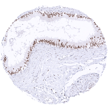 Transcription factor E3 / TFE3