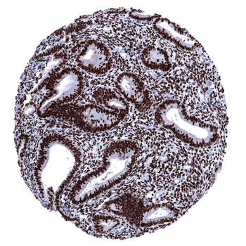 Estrogen Receptor antibody 抗体，