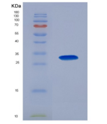 人Ⅺ型胶原α1(COL11a1)重组蛋白