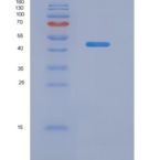 人脂蛋白关联磷脂酶A2(LpPLA2)重组蛋白