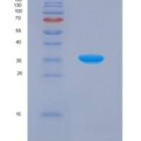 人沉默调节蛋白4(SIRT4)重组蛋白