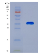 人CREB结合蛋白(CREBBP)重组蛋白