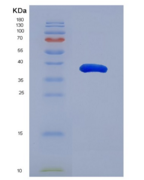 小鼠醛脱氢酶1家族成员A1(ALDH1A1)重组蛋白
