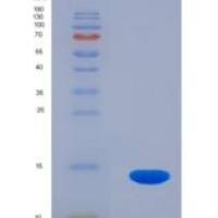 人前胶原赖氨酸-2-酮戊二酸-5-双加氧酶1(PLOD3)重组蛋白