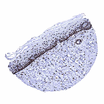 Estrogen Receptor antibody 抗体，