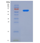 人ANXA5-RFP重组蛋白