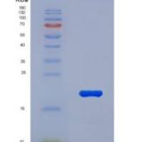 人粘蛋白5AC(MUC5AC)重组蛋白