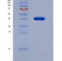 大鼠CD200分子(CD200)重组蛋白